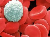 ¿Por sangre color rojo?