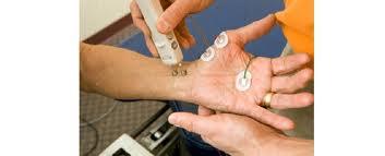 ¿Qué es la Electromiografía?