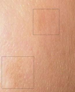 CONCLUSIONES Laboratorio de pruebas 1. Iklen, suero 