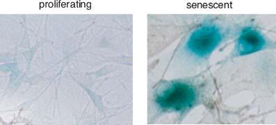 Más allá del ciclo celular: Vida y muerte de la célula