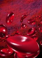 Arteriosclerosis Tratamiento Arteriosclerosis Tratamiento