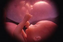 Defectos de nacimiento por fertilización in vitro pueden no estar relacionados con el tratamiento