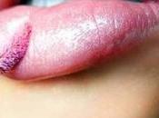 Hablemos glosses...