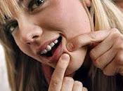 Acne problema comun adolescencia