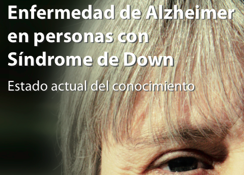 Sindrome de Down y Depresión aumentarán los casos de Alzheimer