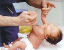 Los reflejos del recién nacido