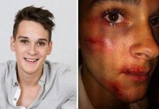 Joven gay multado por fingir ser víctima de agresión homófoba Joven gay multado por fingir ser víctima de agresión homófoba