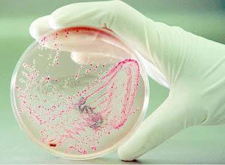 Infección por Escherichia coli (E. coli)