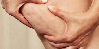 ESPECIAL PIERNAS: CÓMO MEJORAR LA CIRCULACIÓN Y ELIMINAR LA PIEL DE NARANJA O CELULITIS