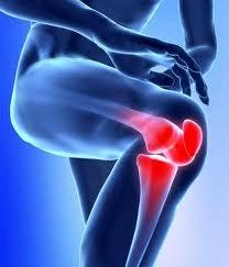 r139 ¿Se pueden prevenir los dolores articulares de la rodilla?