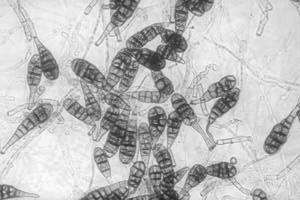 Ya soy oficialmente alérgico