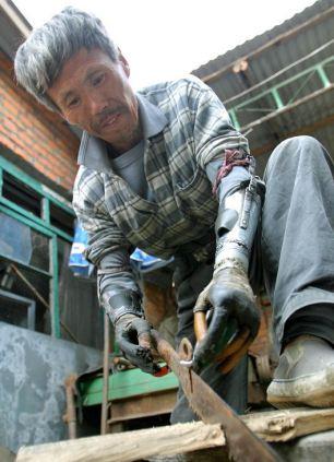 Imagen: Hombre Chino Inventa las Manos Biónicas