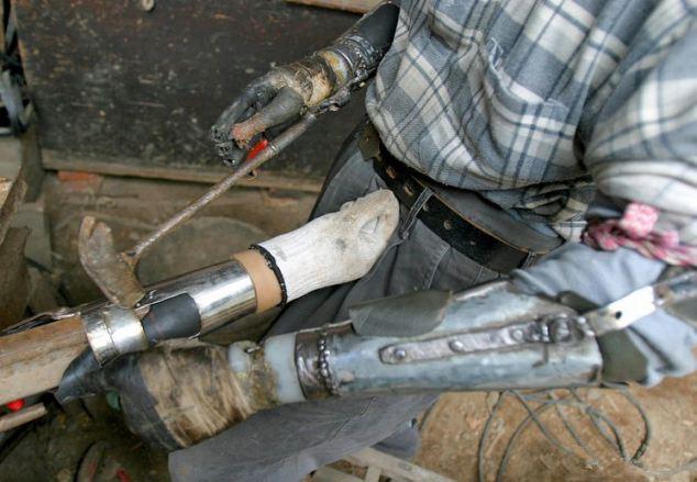 Imagen: Hombre Chino Inventa las Manos Biónicas