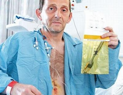 Diez años con un tenedor en el estómago