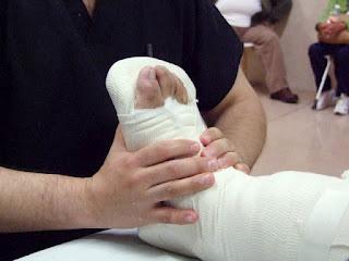 Fracturas de tobillo y muñeca, las lesiones más frecuentes por caídas: IMSS
