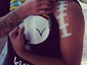 Noticia Urbana: Randy recupera operación brazo izquierdo