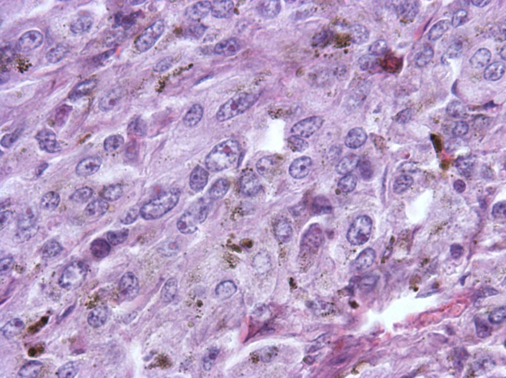 Como beneficia el té nuestra salud