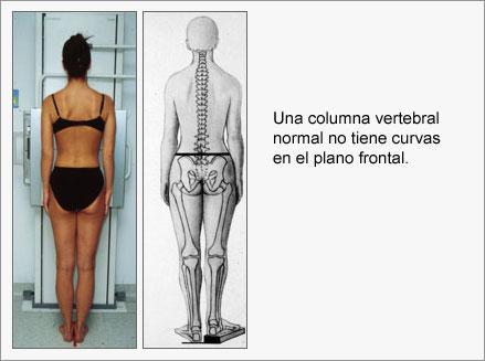 La columna vertebral vista de frente y de perfil