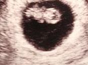 imagen cambió nuestras vidas sobre historia ecografía