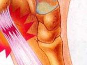 Ejercicios indicados para fascitis plantar