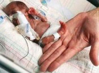 SOBREVIVE UN BEBÉ SUPER-MÍNIMO