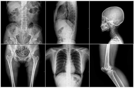 Radiografias del cuerpo humano