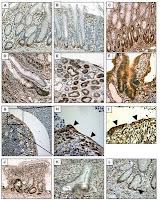 Descubren Proteína que Repara la Pared Intestinal