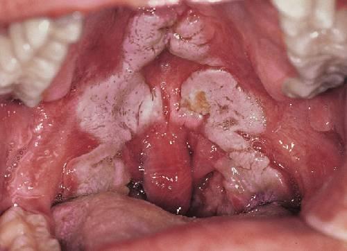 dr house 11 Jugá a ser House   Caso 11