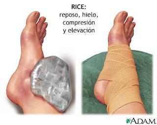 Que podemos hacer con los calcetines que se han quedado sin pareja