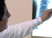 Hipertensión pulmonar, problema puede causar daño grave corazón