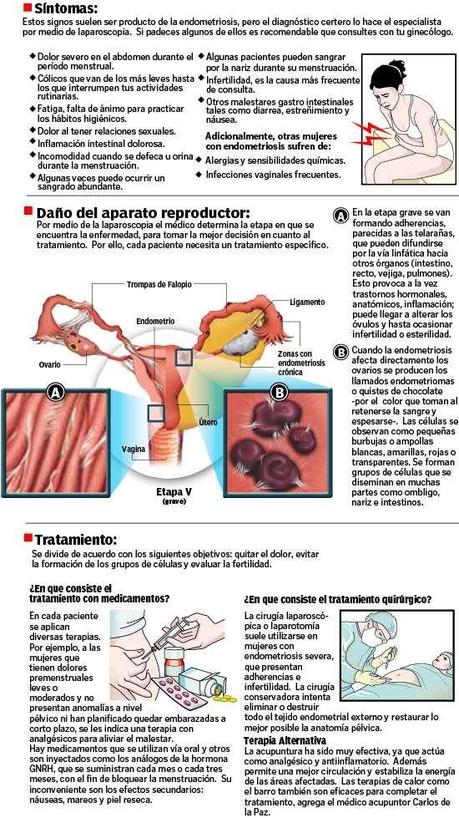 Que es la endometriosis: sus síntomas y tratamiento
