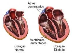 Tratamiento natural de la cardiomegalia