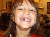 niños españoles tienen mala higiene dental