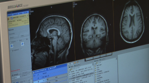 Joven, sano y familiar con Alzheimer? Mira esto