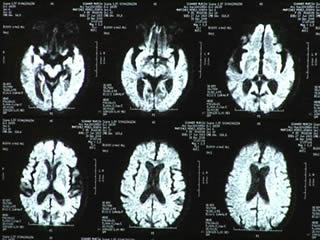 Ensayos de la Vacuna para el 2013