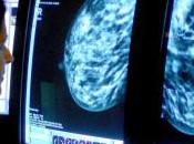 (506) mamografías: beneficios daños