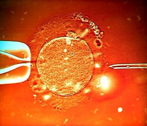 CONSIDERACIONES SOBRE LA FECUNDACIÓN IN VITRO