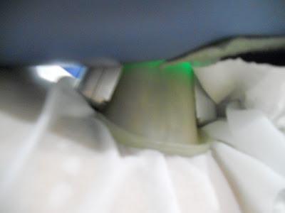 Eliminar la grasa mediante frío,la Criolipólisis.