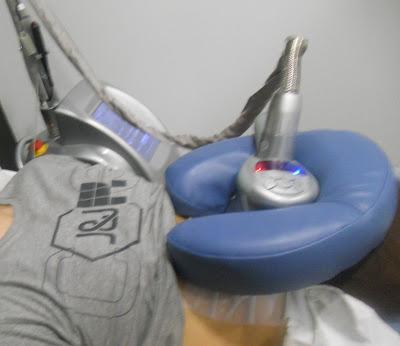 Eliminar la grasa mediante frío,la Criolipólisis.