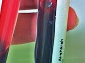 ¿Cómo subir hemoglobina? Hierro bajo