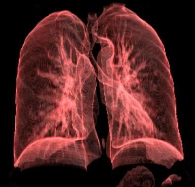 Pulmones Bioartificiales