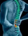 nueva terapia reduce hasta casos dolencias crónicas espalda