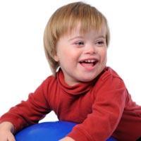 Síndrome de Down podría muy pronto tratarse desde el útero