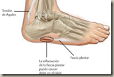 Prevenir fascitis plantar