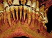 Encuentran momia egipcia 2.100 años antigüedad empastes dientes