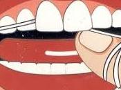 Supuesto práctico. Utilización seda dental