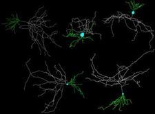 Genes DEC1 y BTRC están desactivados en enfermos de Alzheimer.