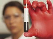 Detección cancer mama análisis sangre