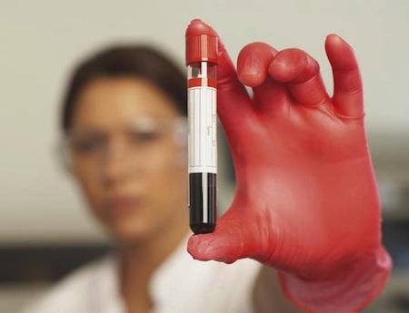 Detección de cancer de mama con un análisis de sangre