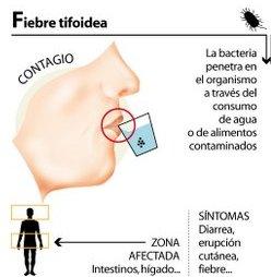 La fiebre tifoidea y sus efectos en nuestra salud